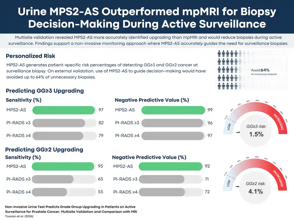 Visual abstract titled 'Urine MPS2-AS Outperformed mpMRI for Biopsy Decision-Making During Active Surveillance.'